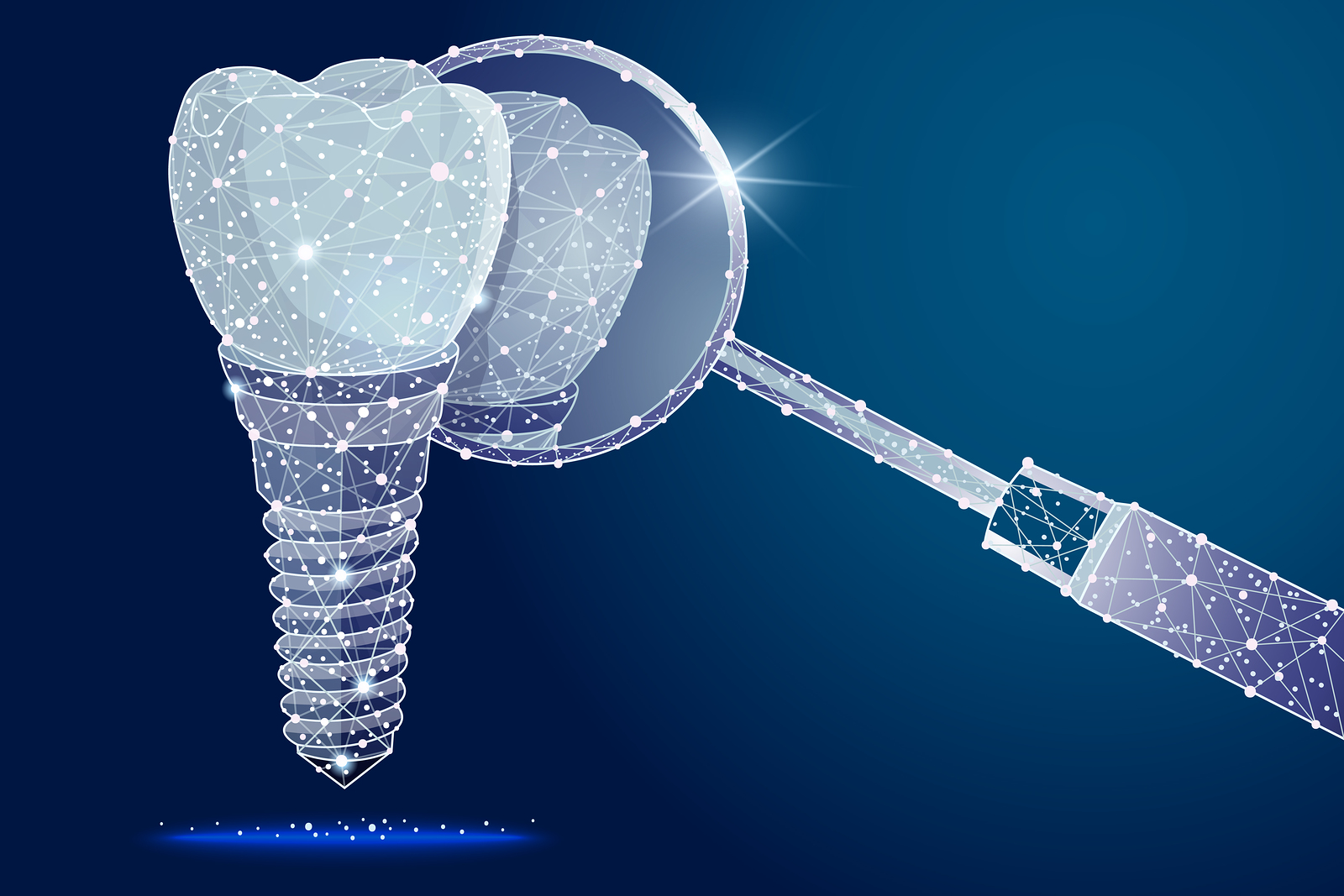 Dental Implants – Know them better