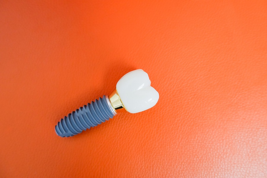 Smile Confidently with Dental Implants
