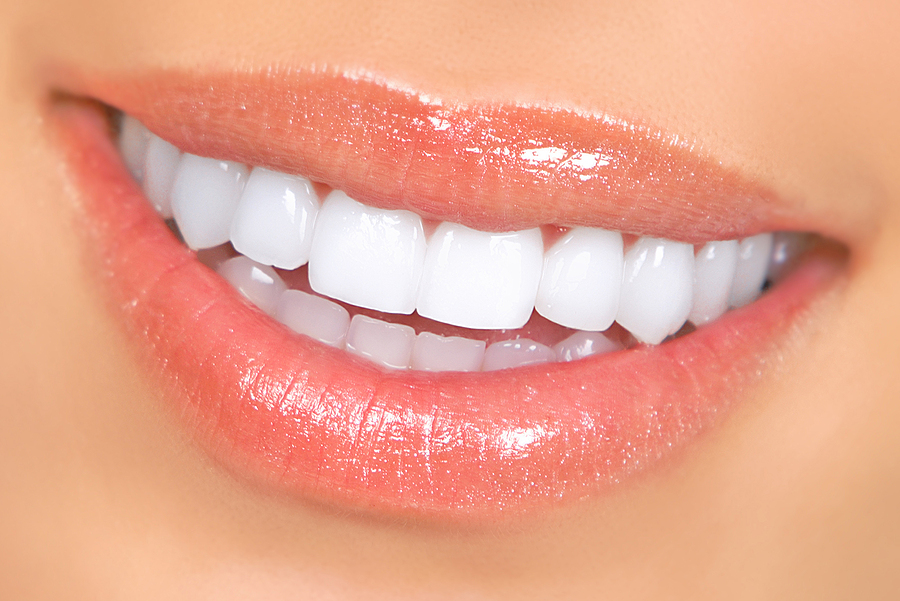 Everything You Need to Know About Same-Day Crowns