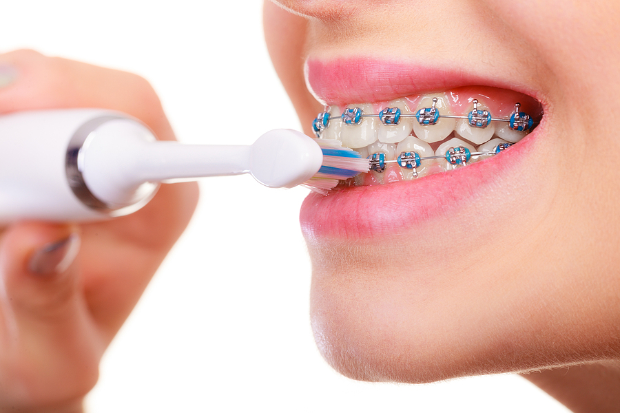 The Role of Orthodontics in Preventing Future Dental Issues